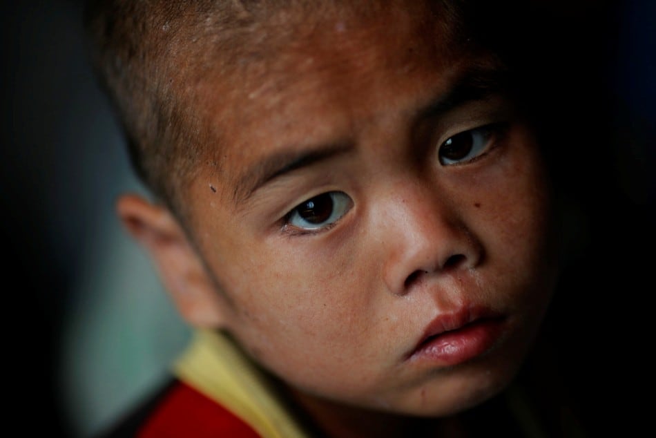 A North Korean child waits to be examined for possible signs of malnutrition in an orphanage in an area damaged by summer floods and typhoons in South Hwanghae province, October 1, 2011. (Photo by Damir Sagolj/Reuters)