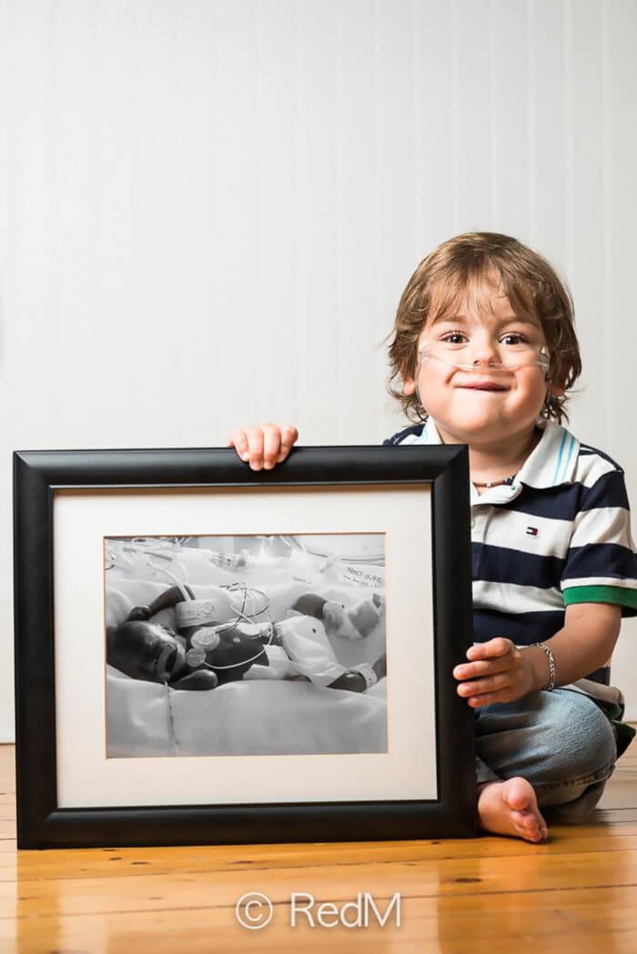Thomas, born at 23 weeks