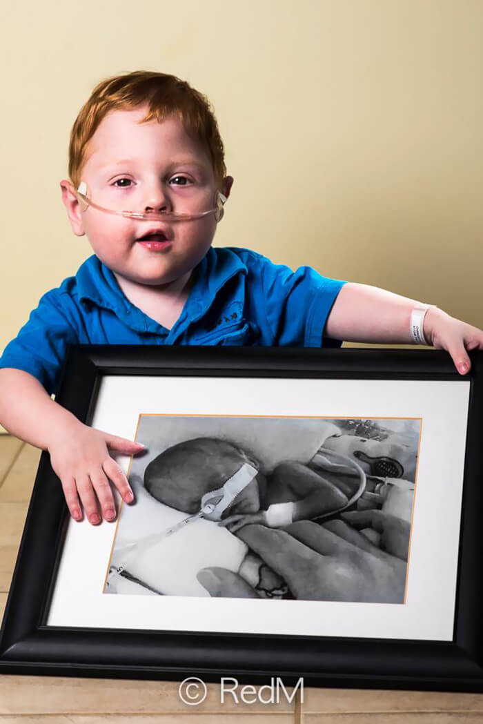 Charles, born at 26 weeks