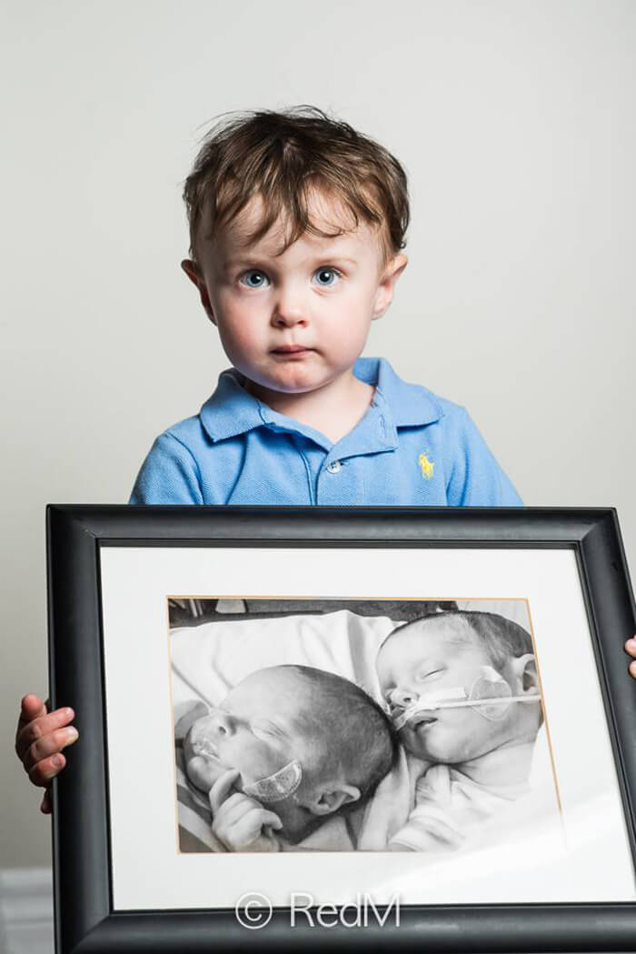 Noah, born at 32 weeks. His twin sister Victoria, left in the framed picture, died after living 1 month