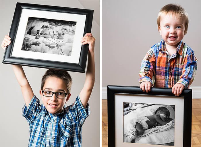 Felix, born at 23 weeks, and his brother Alexis, born at almost 33 weeks