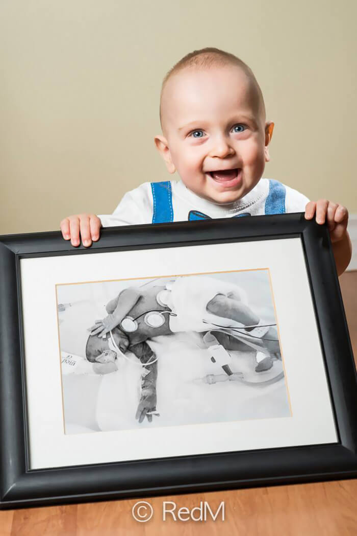 Emile, born at 26 weeks