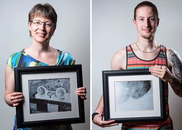 Julie, born at 7 months of pregnancy, and her son Kevin, born at 34 weeks