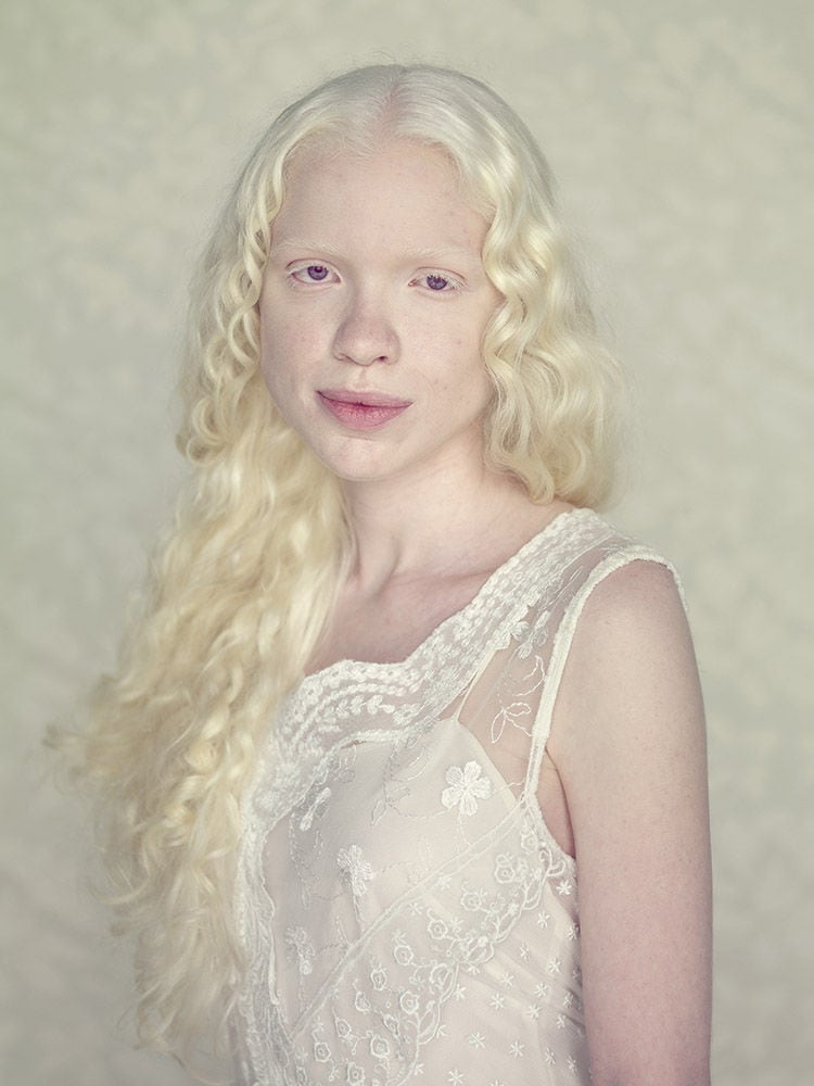 Stunning Portraits Of Albinos By Gustavo Lacerda FREEYORK