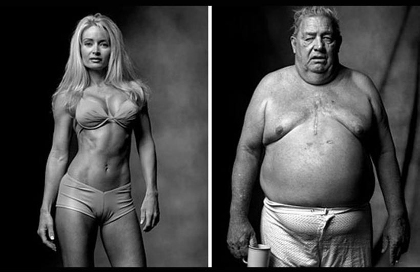 Fitness Model / Heart Surgery Patient